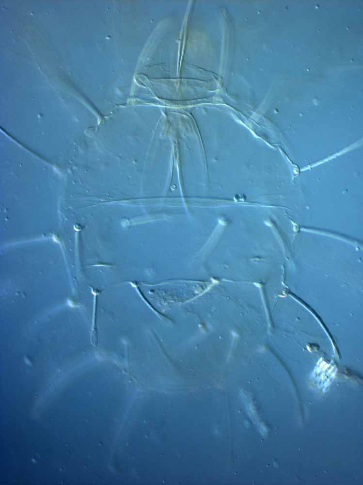            Fig. 2.   Raoiella macfarlanei  female dorsum (type   slide).   