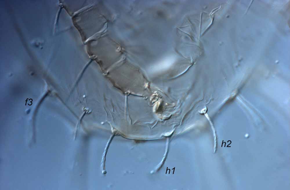            Fig. 4.   Raoiella macfarlanei  female posterior venter (type   slide).   