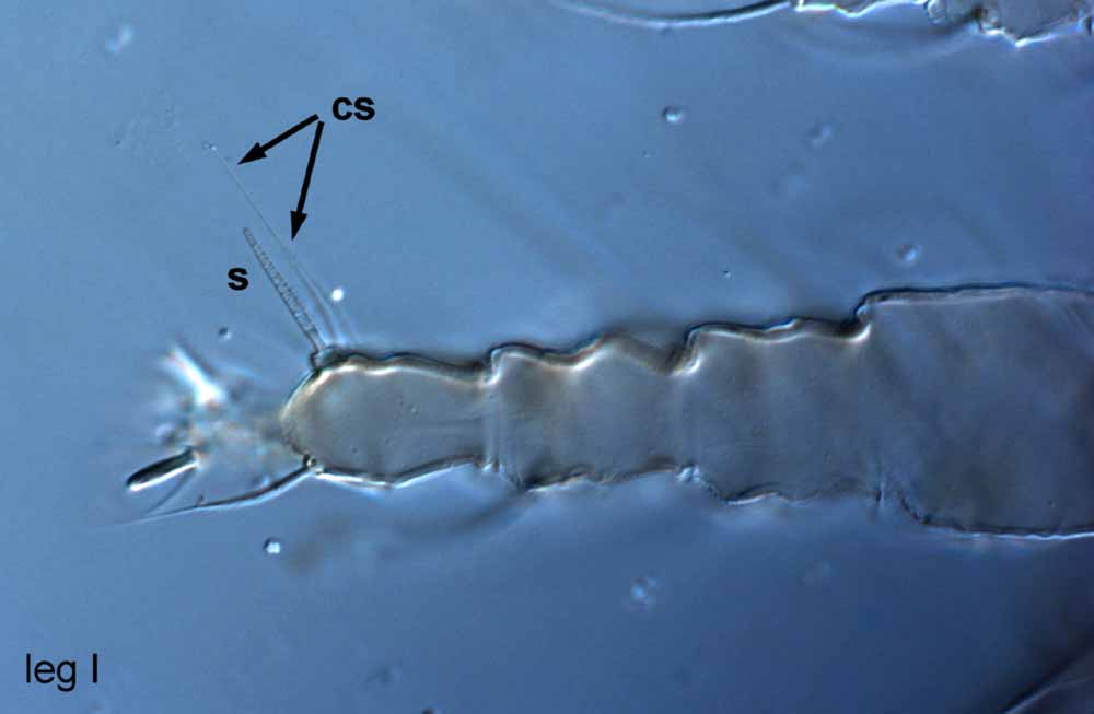            Fig. 6.   Raoiella macfarlanei  female leg I (type slide) (s =   solenidion; cs = companion seta).   