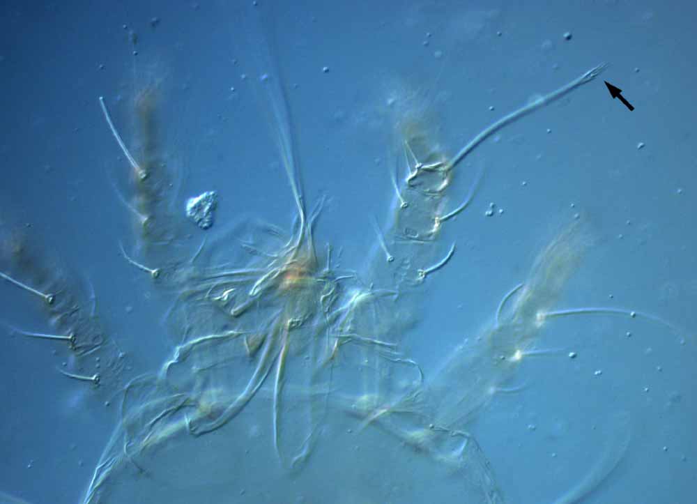            Fig. 8.   Raoiella macfarlanei  female anterior dorsum with legs   I-II (type slide) (arrow indicating dorsal seta on tibia I).   
