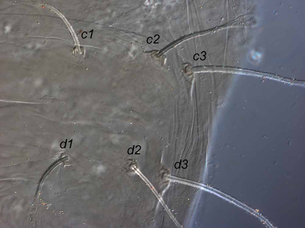            Fig. 3.   Raoiella shimpana  female paratype anterior   dorsolateral opisthosoma.   