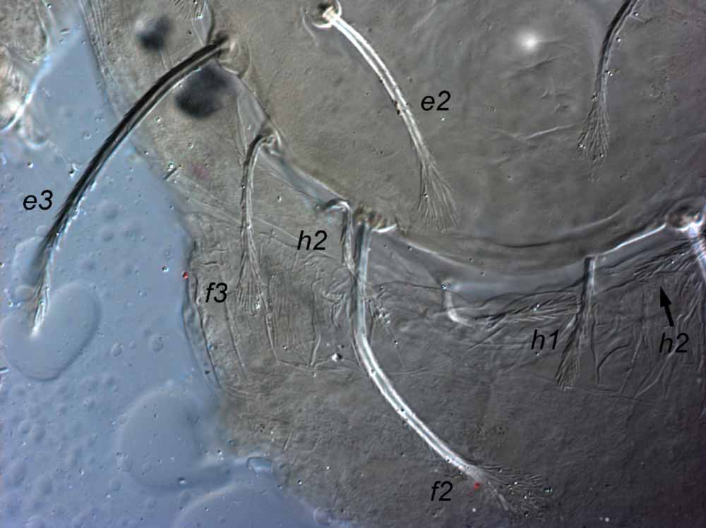            Fig. 5.   Raoiella shimpana  female paratype posterior   dorsum.   