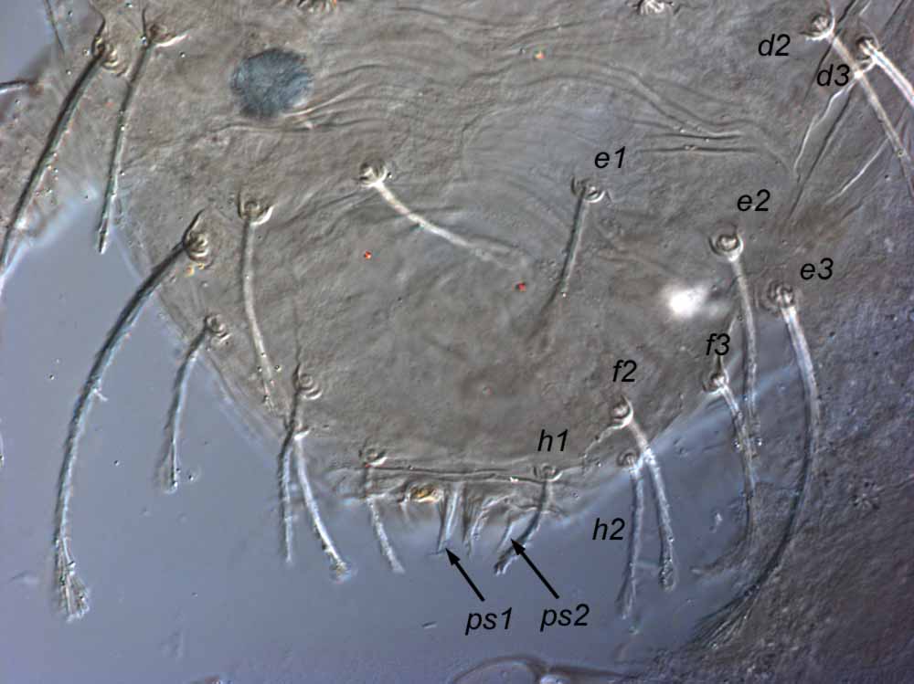            Fig. 9.   Raoiella shimpana  male paratype posterior   dorsum.    