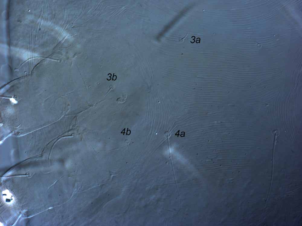  Fig. 4.  Raoiella argenta nbsp;female venter - coxae III and IV. 
