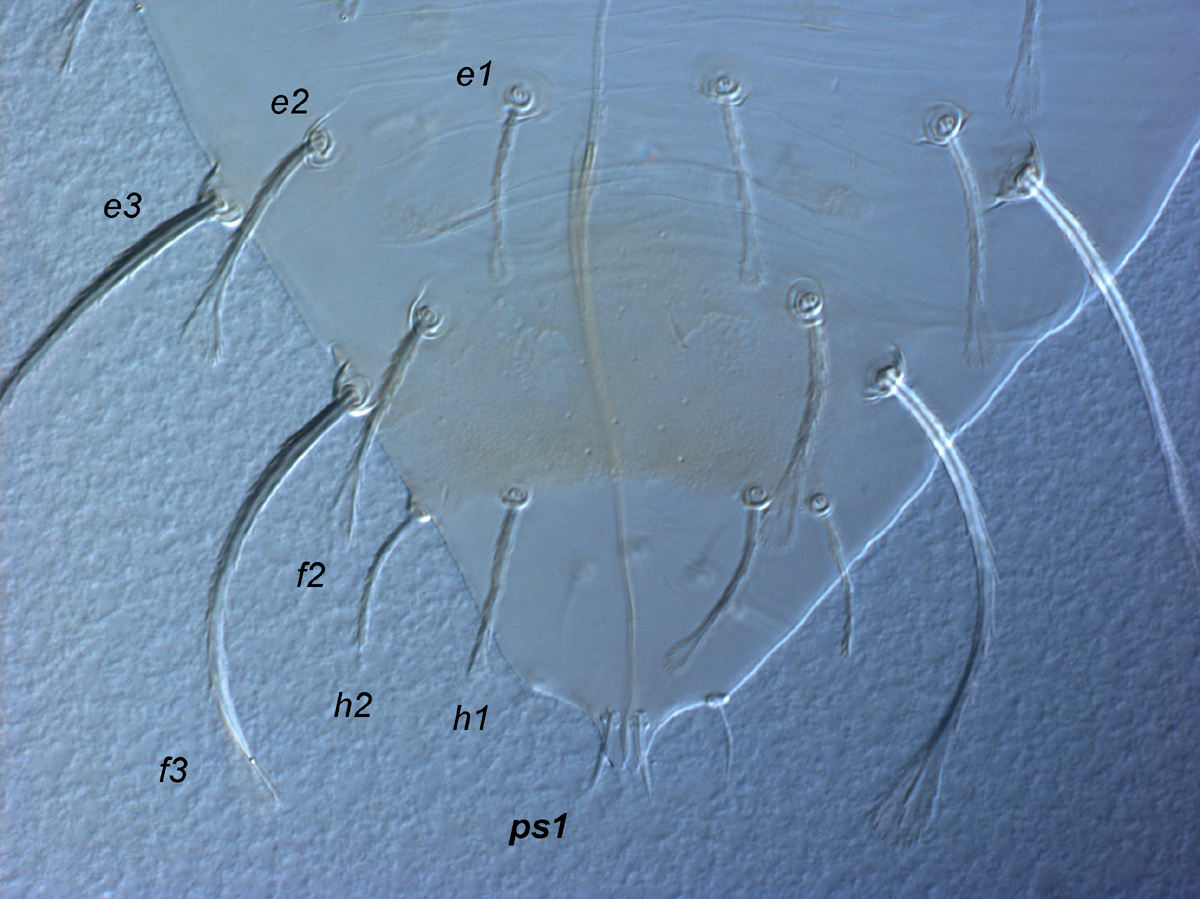  Fig. 10.  Raoiella calgoa nbsp;adult male posterior dorsum indicating setae  ps1 . 
