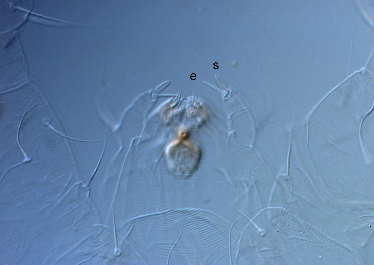            Fig. 10.   Raoiella australica  adult female palps (s =   solenidion, e = eupathidium).   