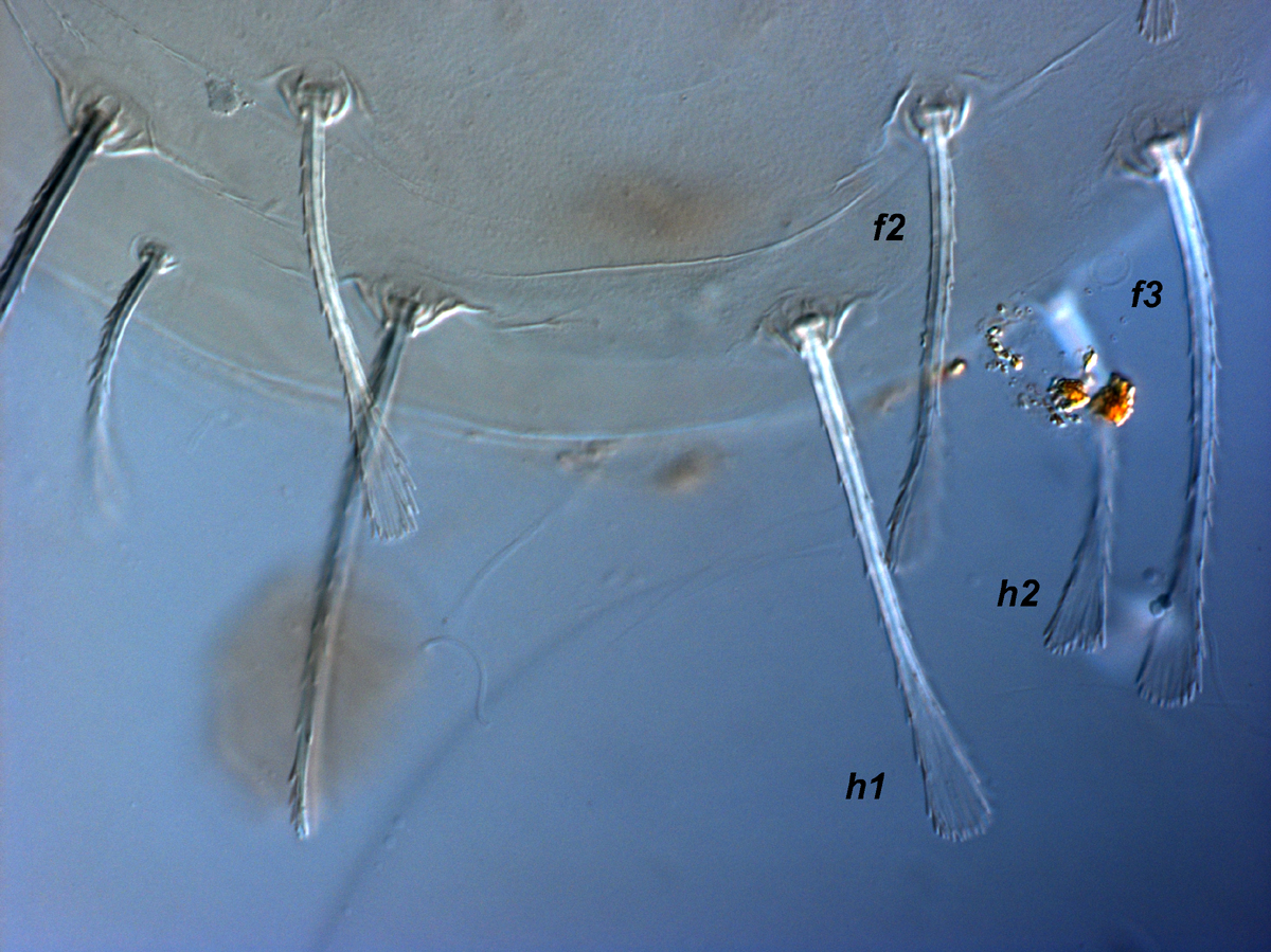  Fig. 4.  Raoiella bauchani nbsp;adult female, posterior dorsum. 
