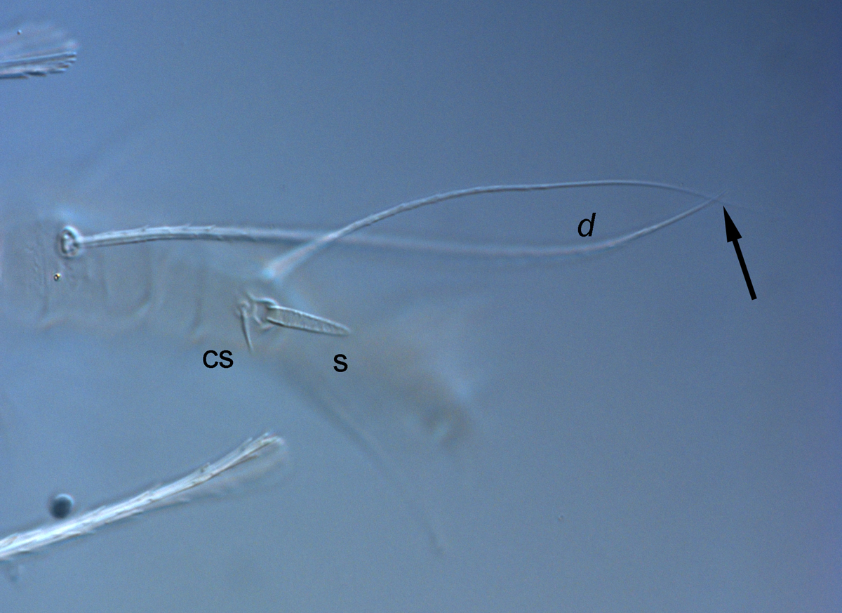  Fig. 6.  Raoiella bauchani nbsp;adult female leg II ( d  = dorsal seta on tibia II, s = solenidion, cs = companion seta). 
