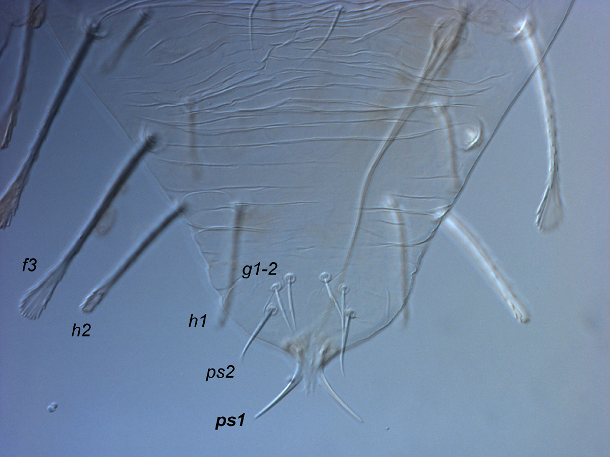  Fig. 11.  Raoiella bauchani nbsp;adult male, posterior venter, indicating elongate setae  ps1 . 
