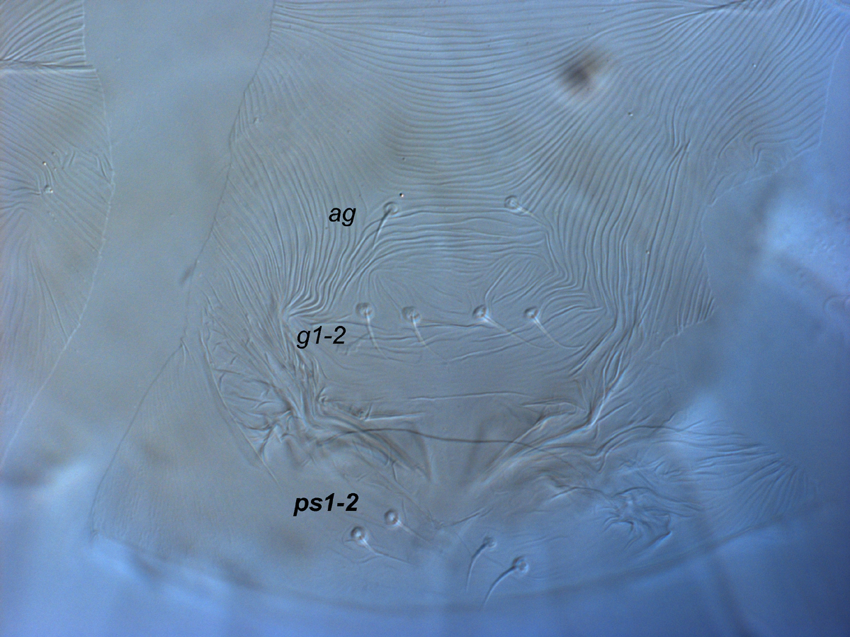  Fig. 10.  Raoiella crebra nbsp;adult female posterior venter (genital region). 
