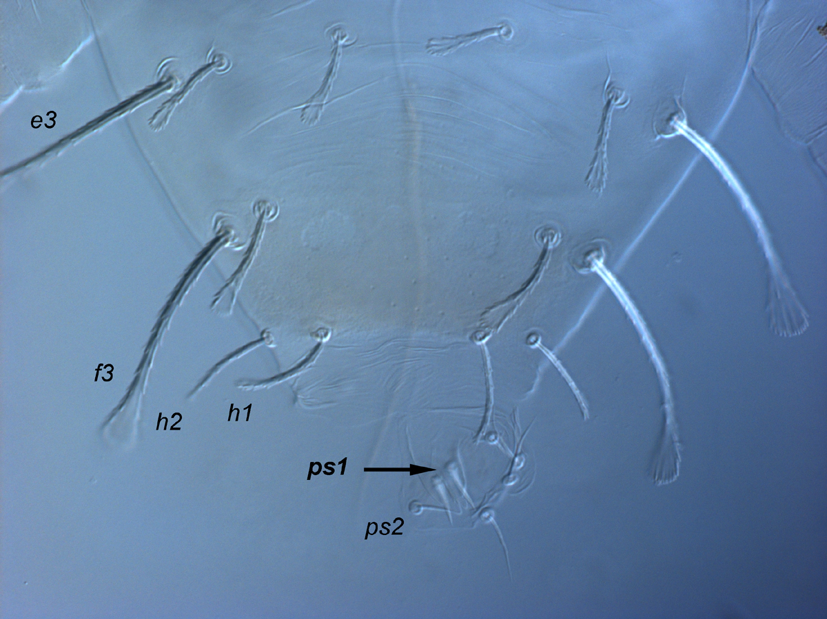  Fig. 11.  Raoiella crebra nbsp;adult male posterior opisthosoma, indicating setae  ps1  (arrow). 
