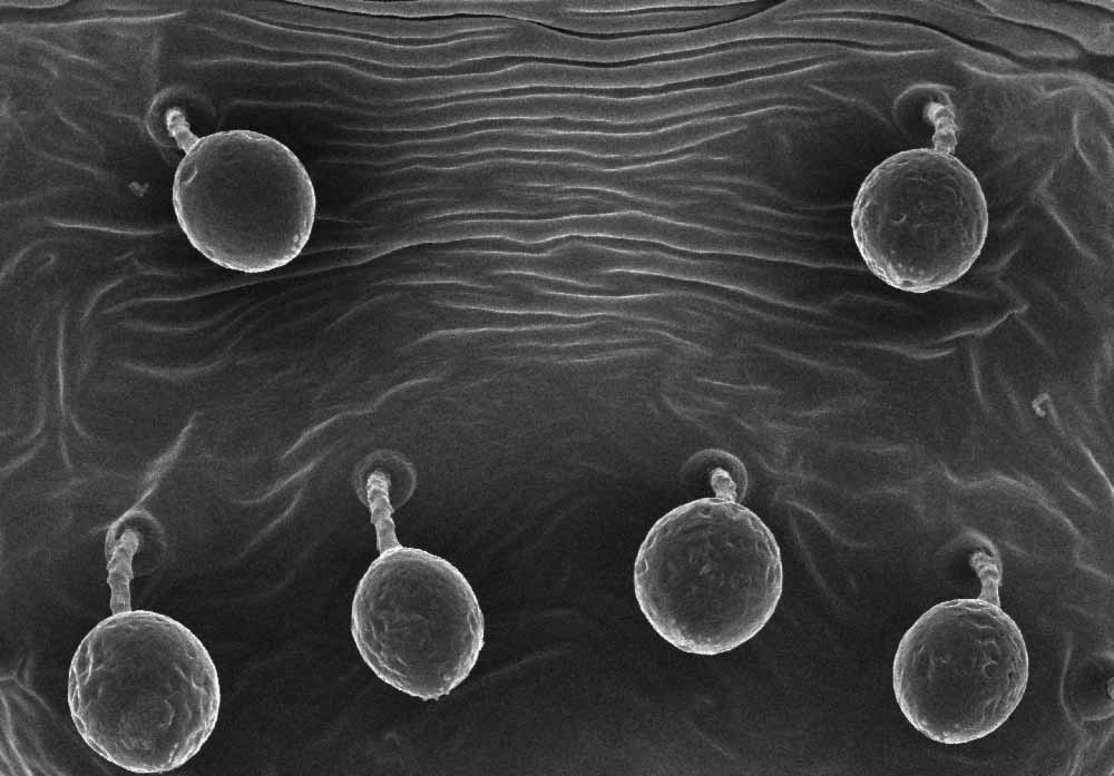  Fig. 9.  Raoiella tallerack nbsp;deutonymph, dorsal setae with frozen droplets (image: Gary Bauchan, USDA-ARS). 

