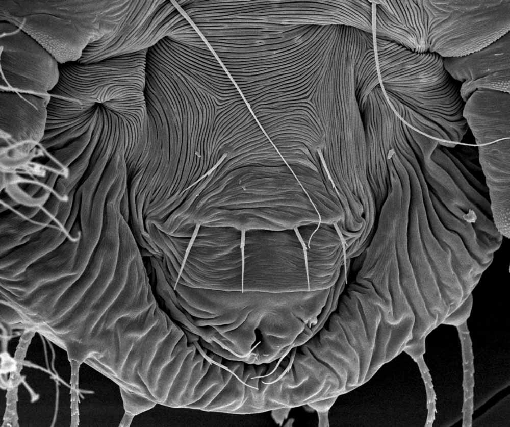  Fig. 7.  Raoiella bauchani , female posterior venter, with detail of genital region (image: Gary Bauchan, USDA-ARS). 
