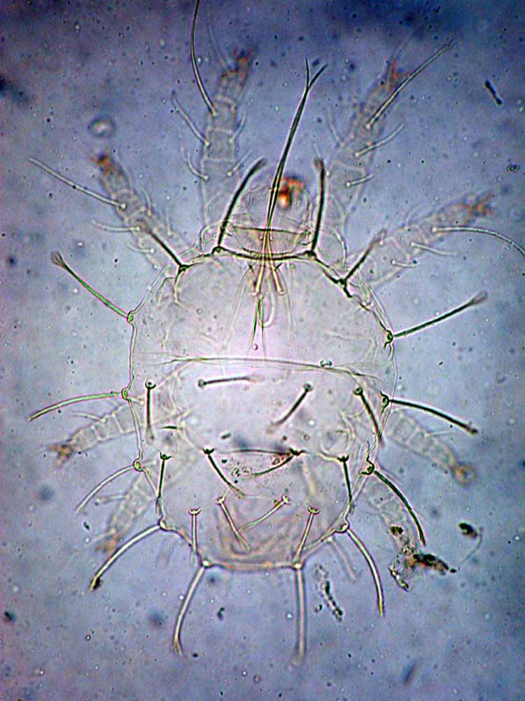            Fig. 1.   Raoiella macfarlanei  female dorsum (type slide; image   taken by Ethan Kane).   