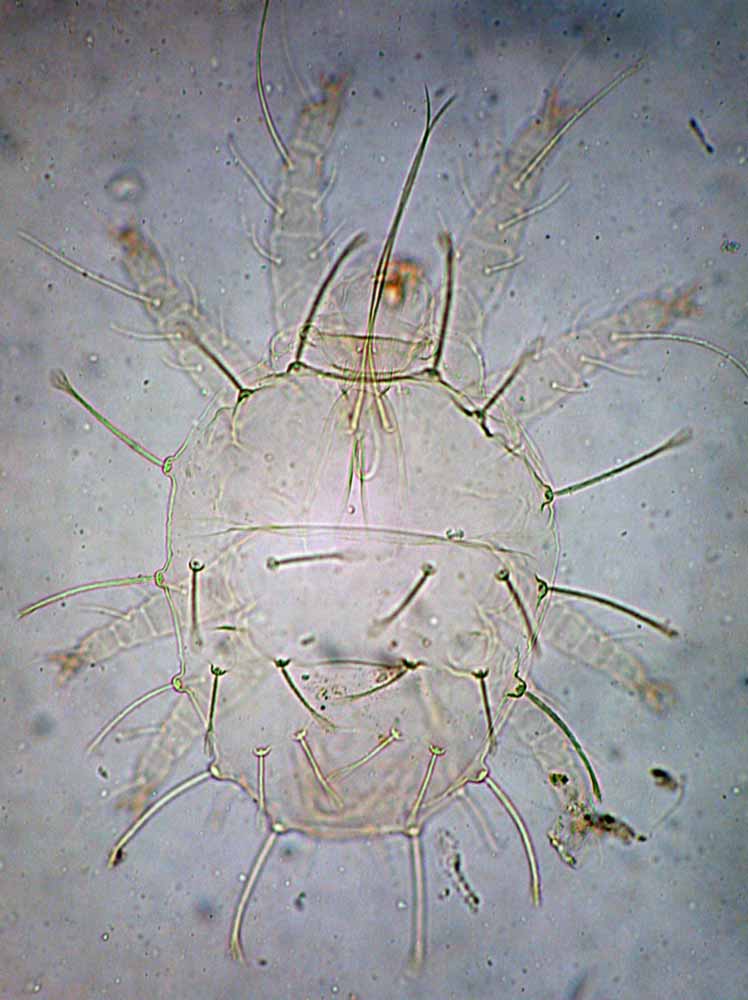            Fig. 3   Raoiella macfarlanei  female   dorsum (type specimen).   