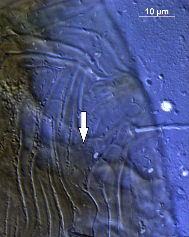 Fig. 5.  Raoiellana allium  female eyes