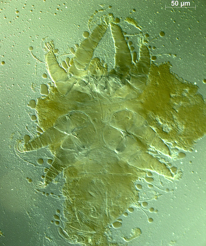 Fig. 4.  Raoiellana allium  male venter