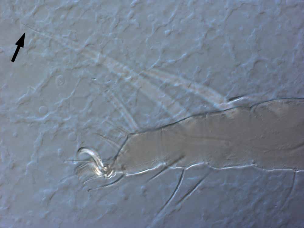            Fig. 9.   Raoiella indica  female leg I (arrow indicating dorsal   seta on tibia).   