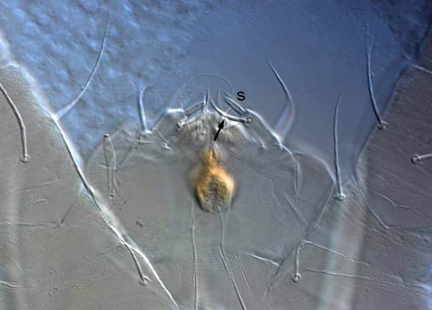            Fig. 10.   Raoiella indica  adult female palp (s =   solenidion; e = eupathidium).   