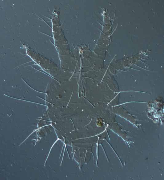            Fig. 13.   Raoiella indica  male dorsum.   