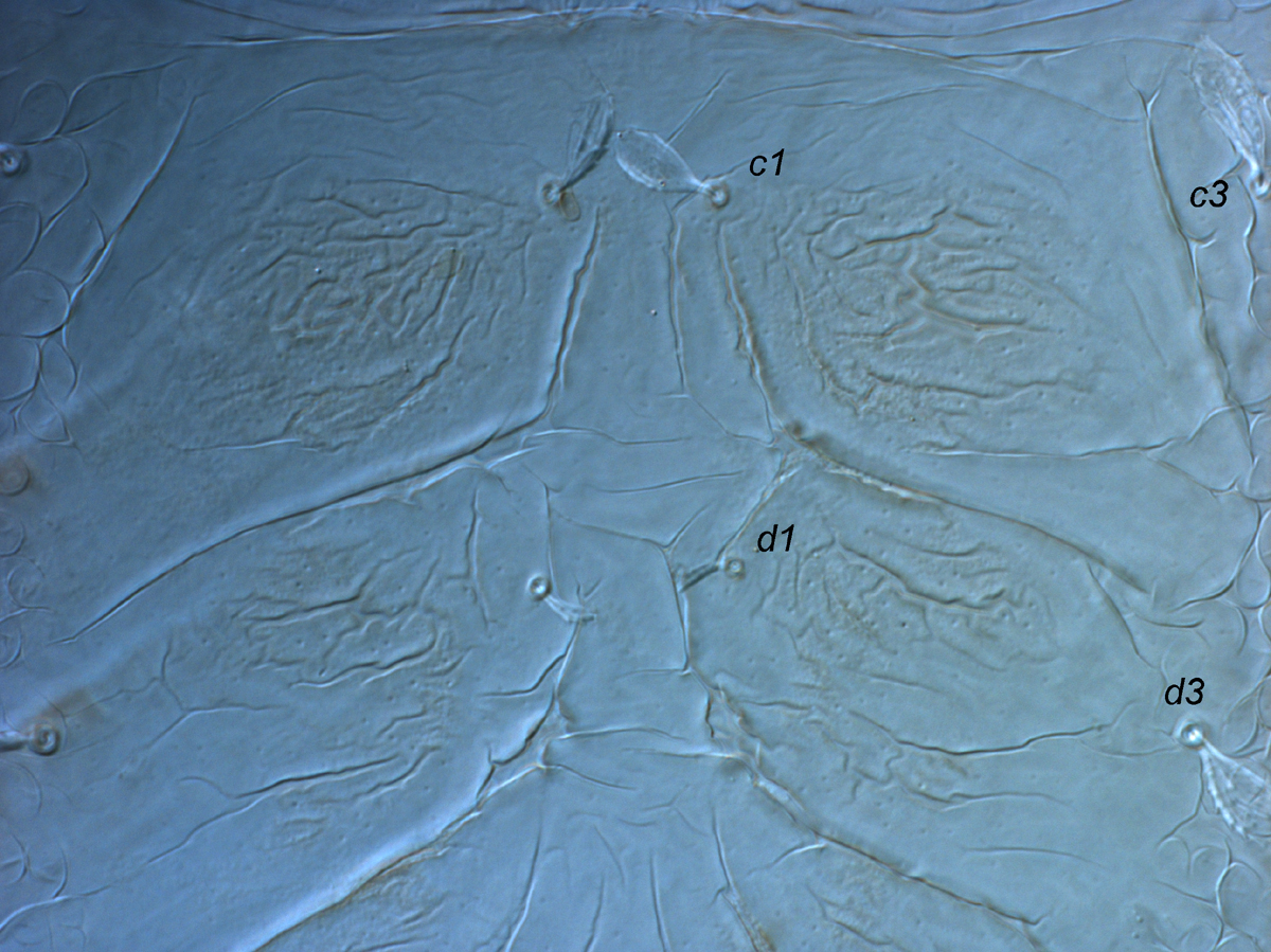            Fig. 3.  Tegopalpus conicus , adult female anterior opisthosoma,   indicating absence of  c2 ,  d2 ,  e2 .   