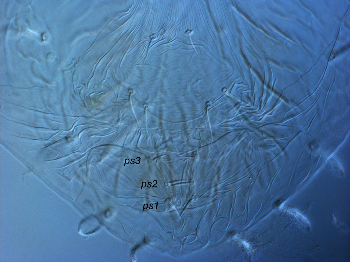            Fig. 8.  Tegopalpus conicus , adult female posterior   venter.   