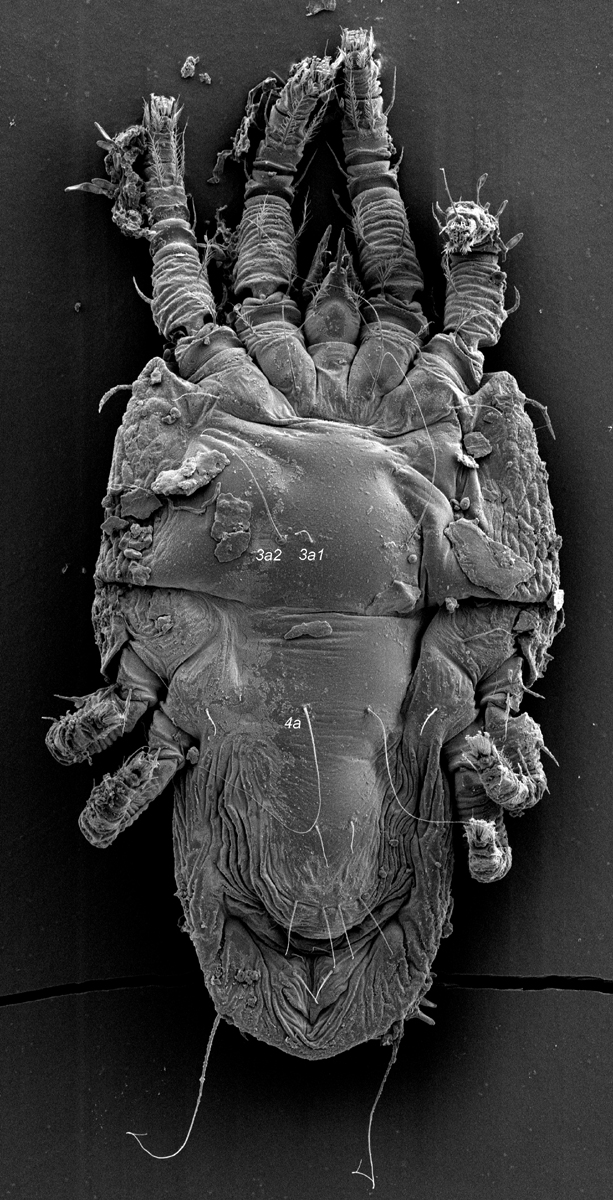  Fig. 9.  Tenuipalpus  sp. nov. nr  crassulus  female venter (Image: Gary R. Bauchan, USDA-ECMU).
