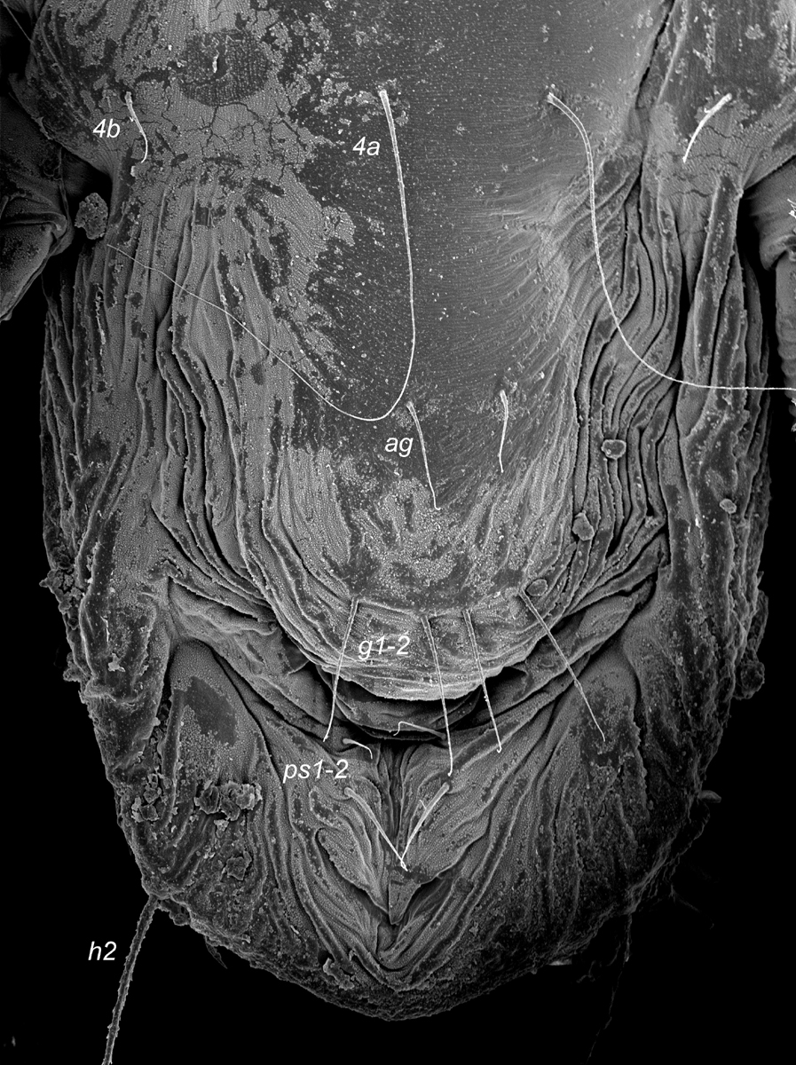 Fig. 10.  Tenuipalpus  sp. nov. nr  crassulus  female posterior venter, indicating genital region (Image: Gary R. Bauchan, USDA-ECMU).
