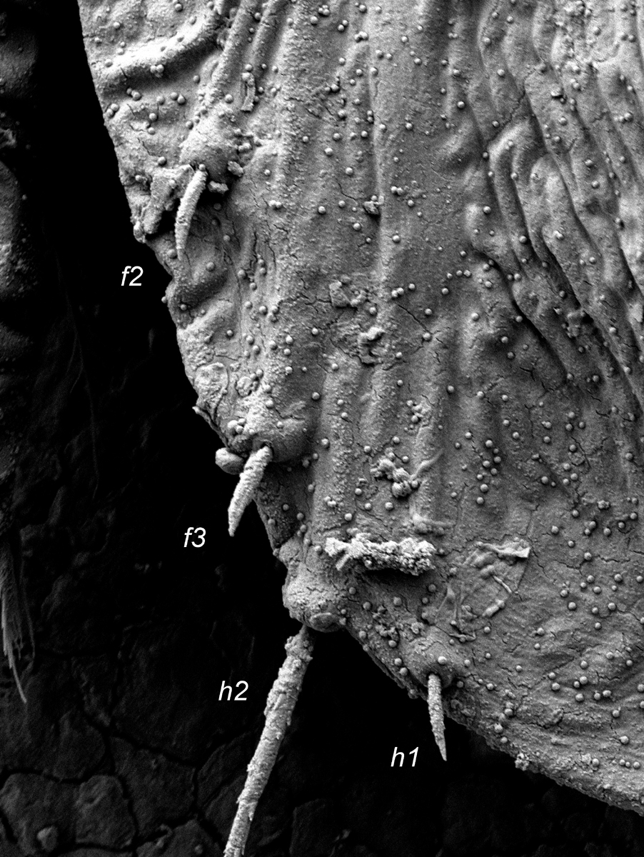  Fig. 7.  Tenuipalpus  sp. nov. nr  crassulus  female posterior   dorsum, indicating lateral setae.