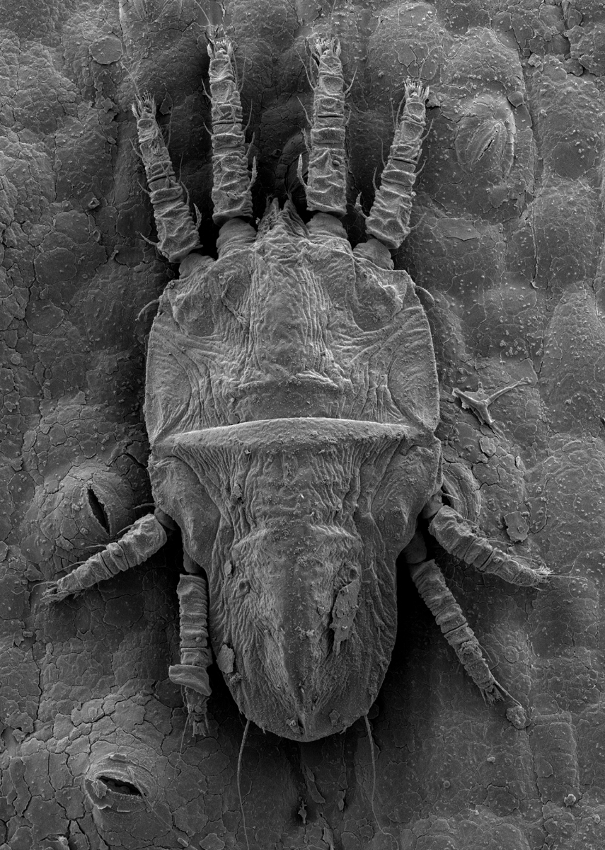  Fig. 2.  Tenuipalpus  sp. nov. nr  crassulus  female dorsum   (Image: Gary R. Bauchan, USDA-ECMU). 