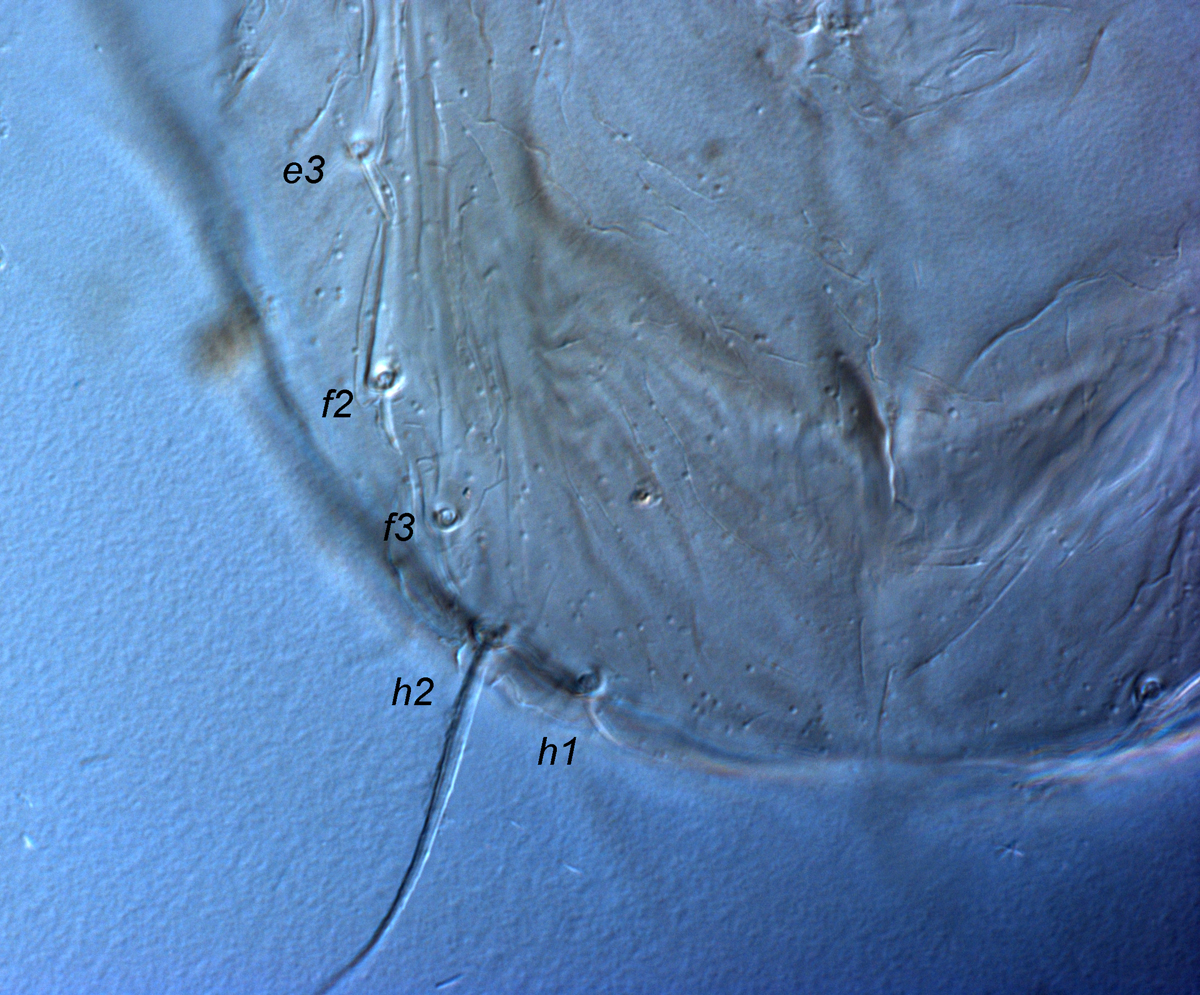  Fig. 6.  Tenuipalpus  sp. nov. nr  crassulus  female posterior   dorsum, indicating lateral setae. 
