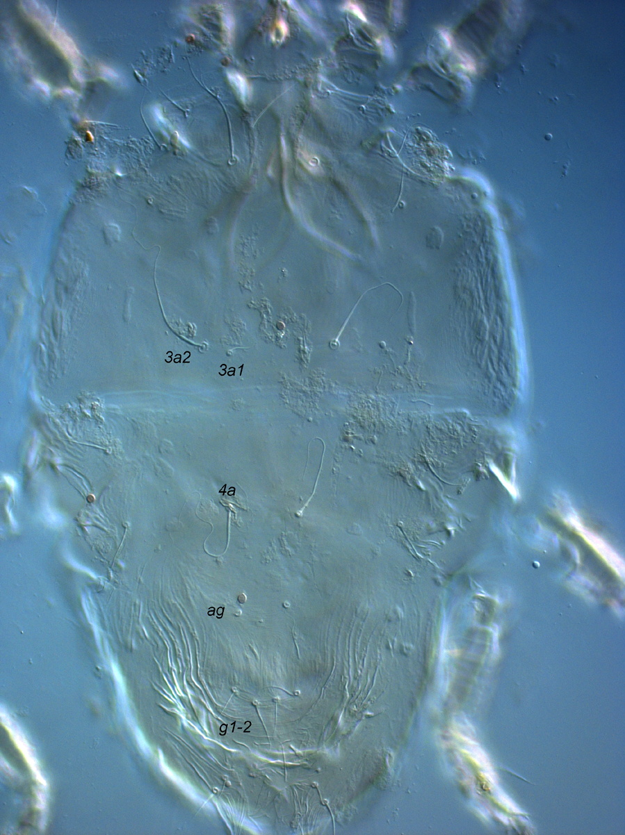  Fig. 8.  Tenuipalpus  sp. nov. nr  crassulus  female venter.   