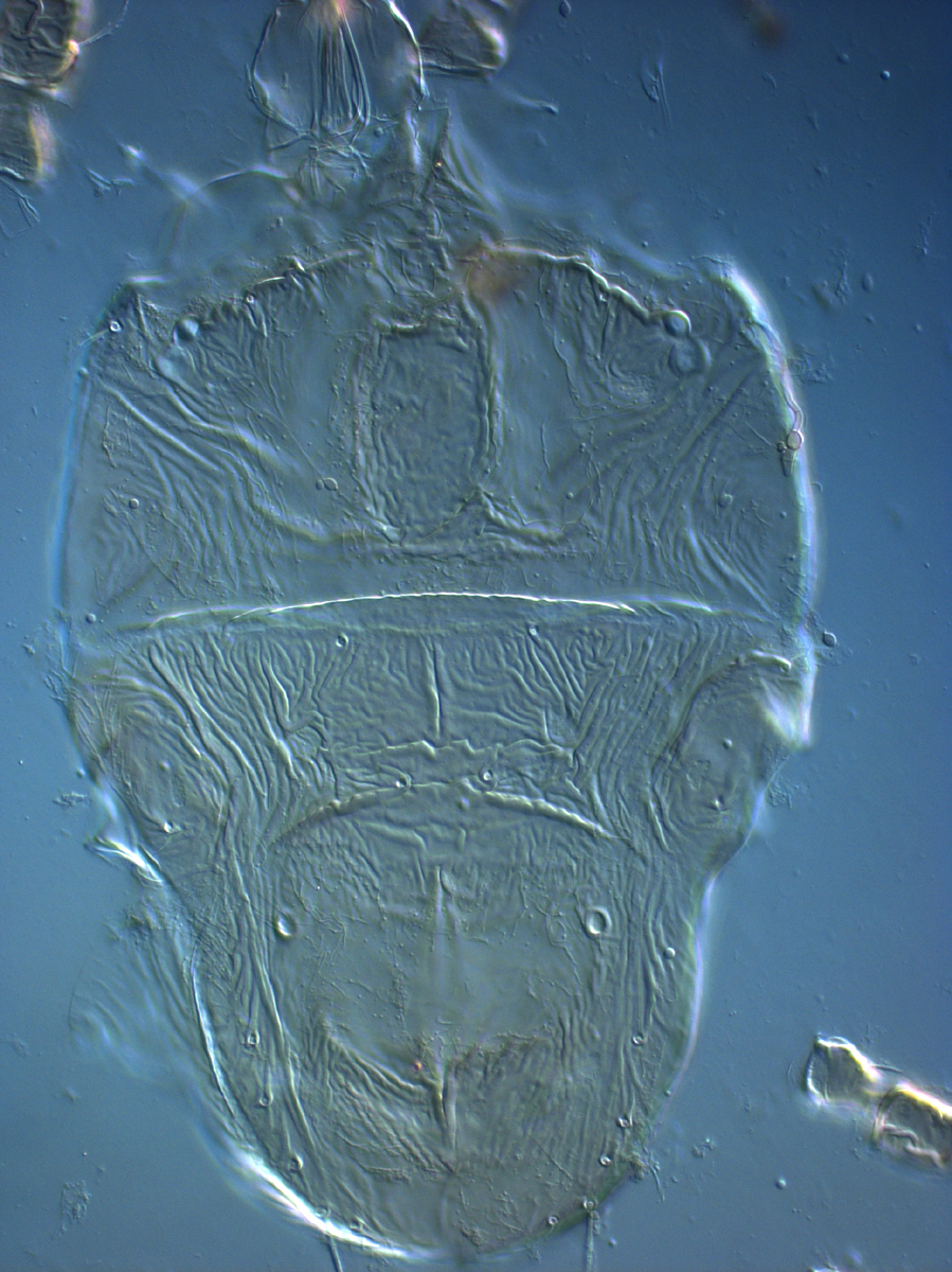  Fig. 1.  Tenuipalpus  sp. nov. nr  crassulus  female   dorsum.