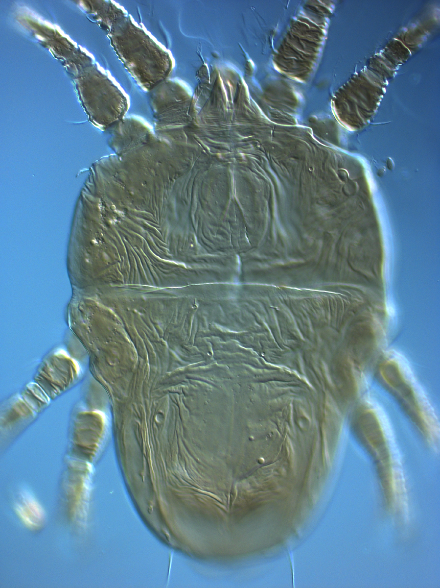  Fig. 1.  Tenuipalpus crassulus  female dorsum (holotype).
