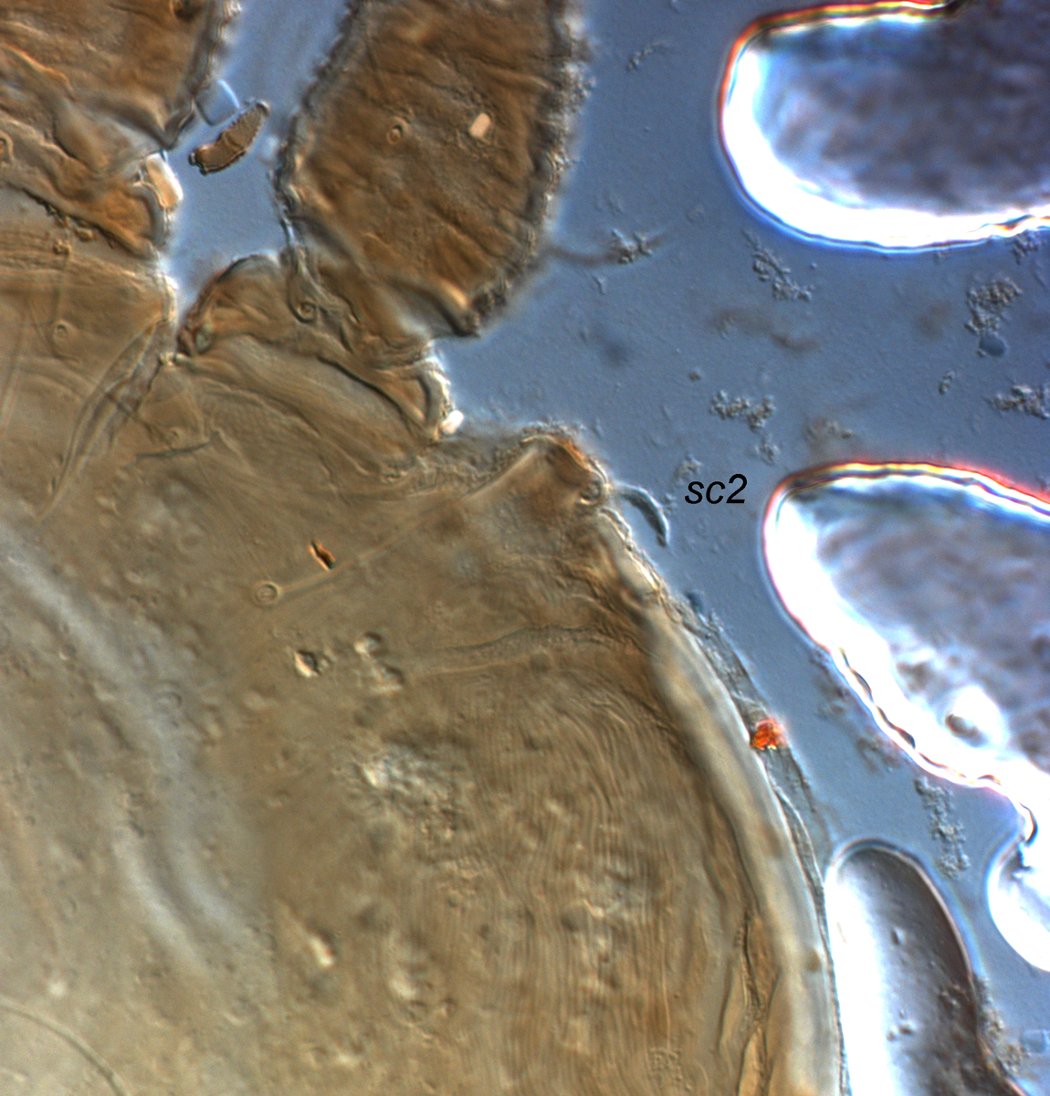 Fig. 2.  Tenuipalpus crassulus  female prodorsal setae  sc2 .
