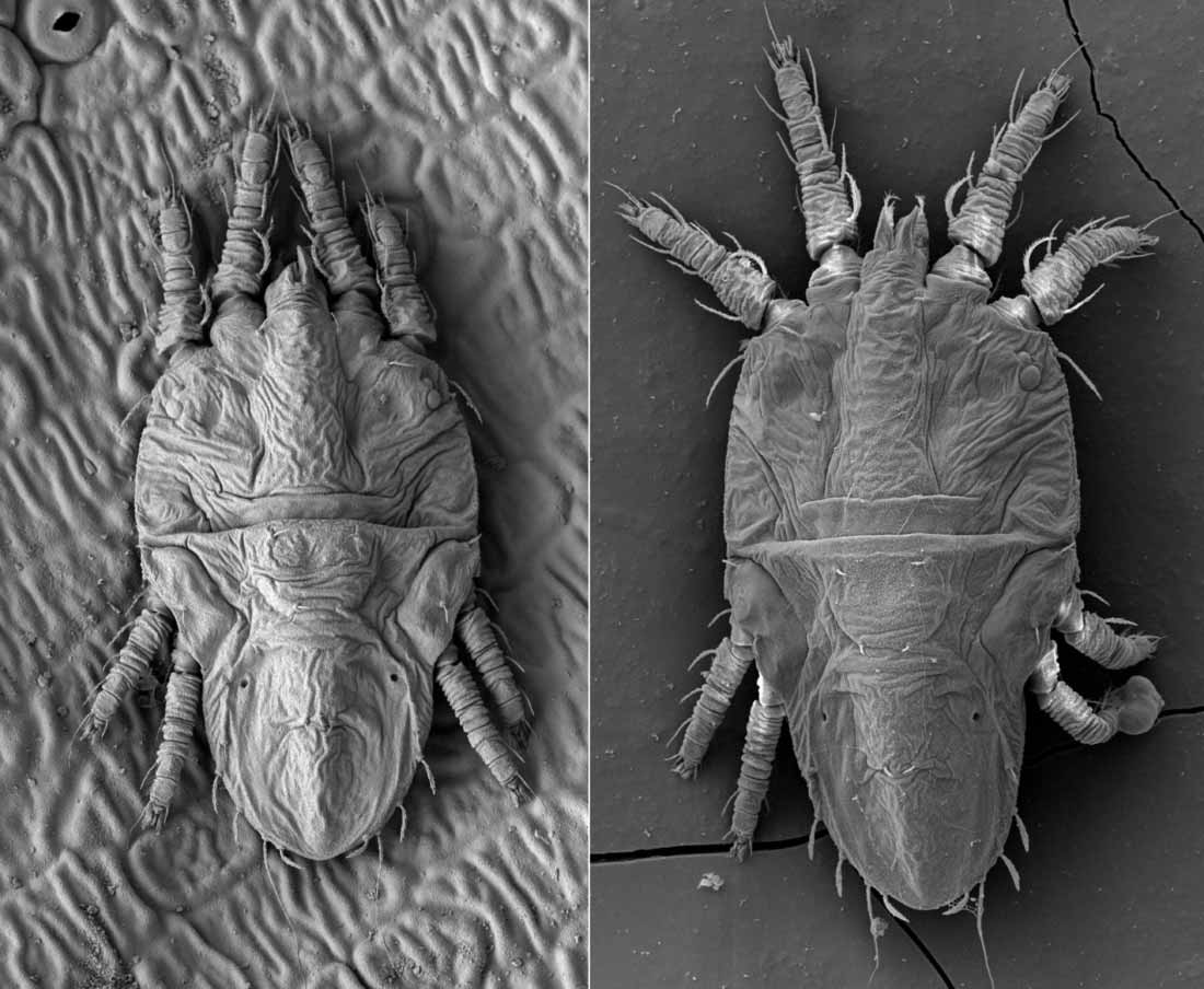            Fig. 3.   Tenuipalpus pacificus  female dorsum   (images: Gary Bauchan, USDA-ARS).   