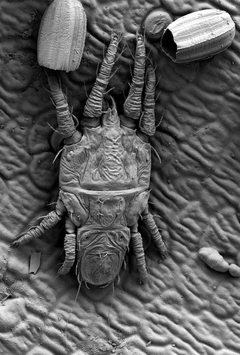            Fig. 14.   Tenuipalpus pacificus  male dorsum, with hatched   eggs (images: Gary Bauchan, USDA-ECMU).   