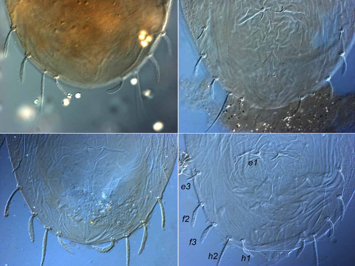            Fig. 3.   Tenuipalpus pacificus  female posterior   dorsum.   
