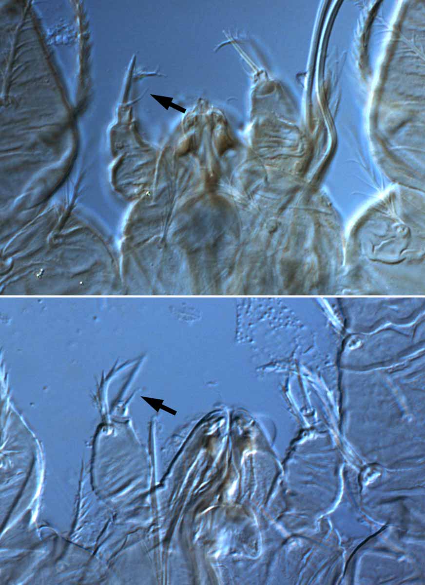            Fig. 11.   Tenuipalpus pacificus  female palp - arrow indicates   short tapered seta.   