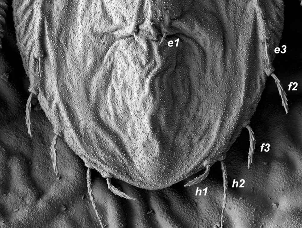            Fig. 4.   Tenuipalpus pacificus  female   posterior dorsum (image: Gary Bauchan, USDA-ARS).   