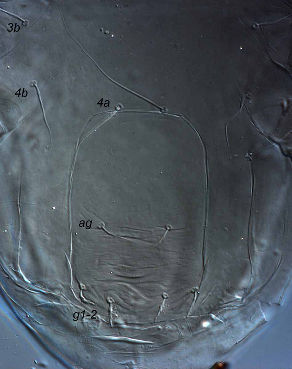            Fig. 6.   Terminalichus  sp. female posterior   venter.   