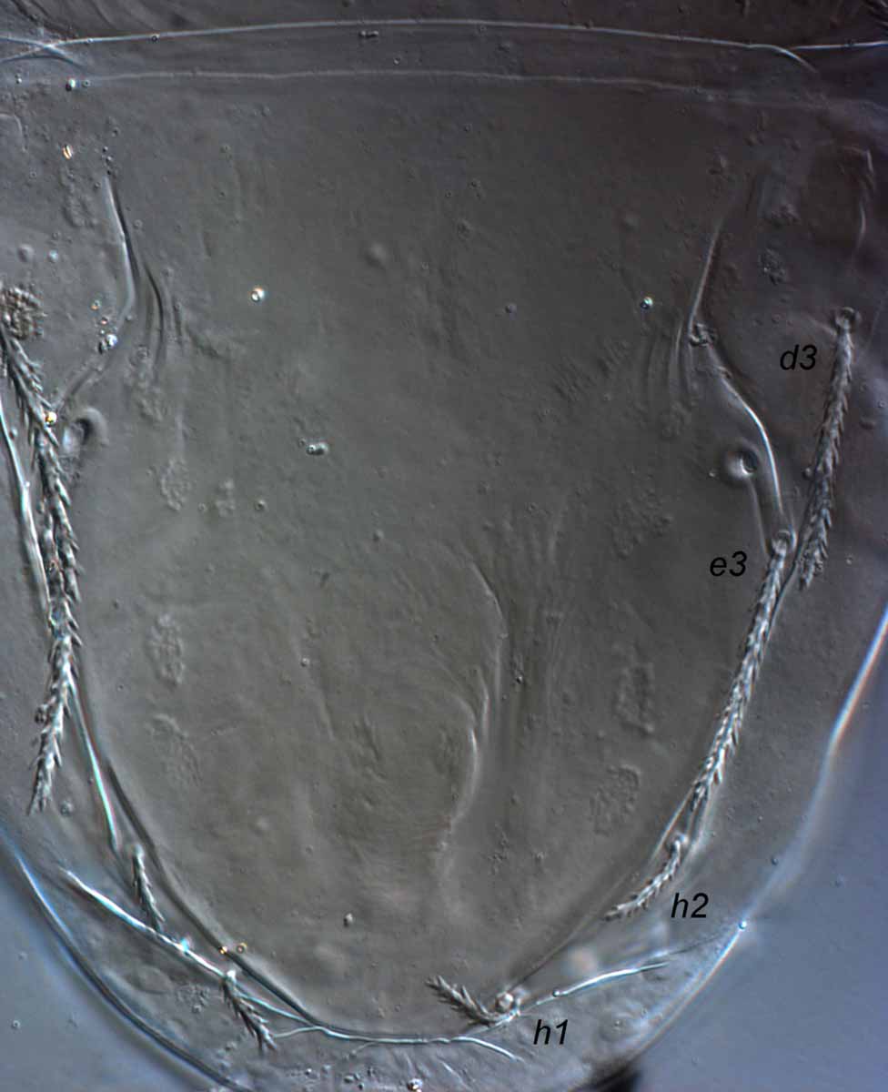            Fig. 3.   Terminalichus  sp. female posterior   dorsum.   