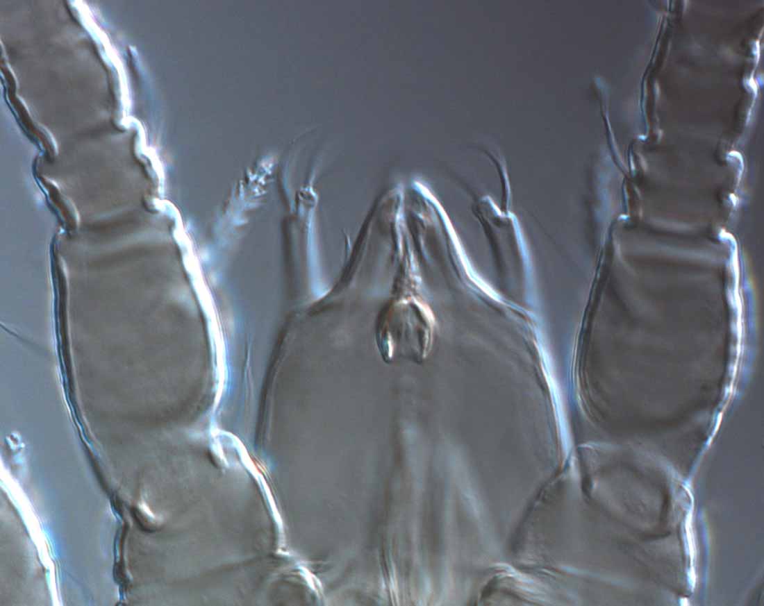            Fig. 7.   Terminalichus  sp. female gnathosoma   with palps.   