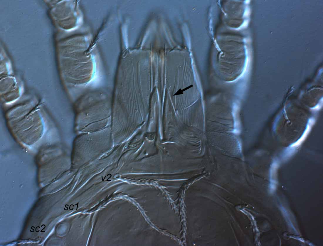            Fig. 4.   Terminalichus  sp. female   prodorsum.   