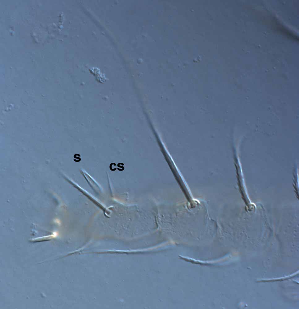            Fig. 5.   Raoiella eugeniae  adult female leg II (s =   solenidion; cs = companion seta).   