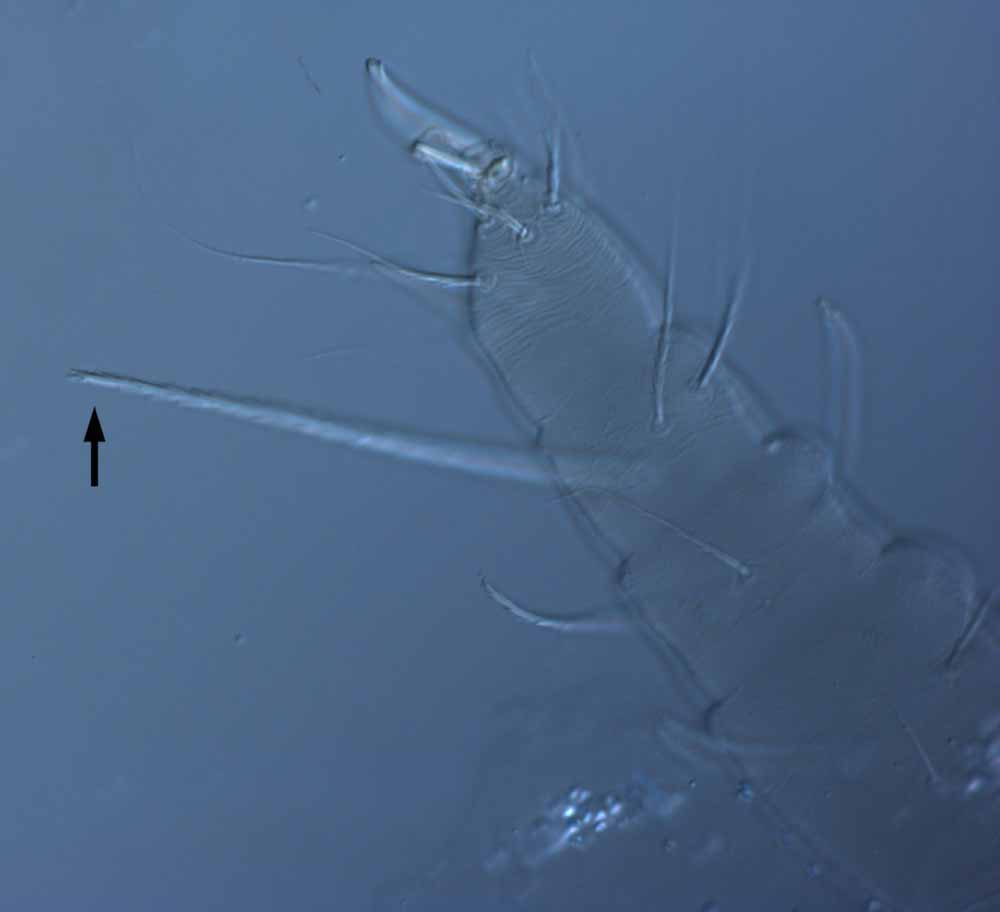  Fig. 5.  Raoiella hallingi nbsp;adult female leg I (arrow indicates dorsal seta on tibia). 
