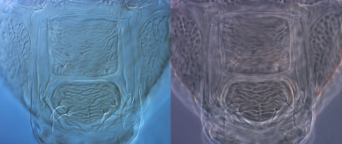 Figure 1: DIC view on left, phase contrast view on right