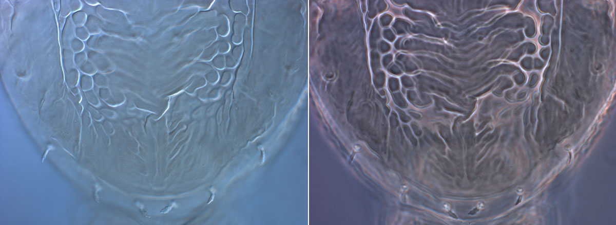 Figure 2: DIC view on left, phase contrast view on right