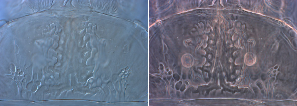 Figure 3: DIC view on left, phase contrast view on right; internal structures visible in phase contrast