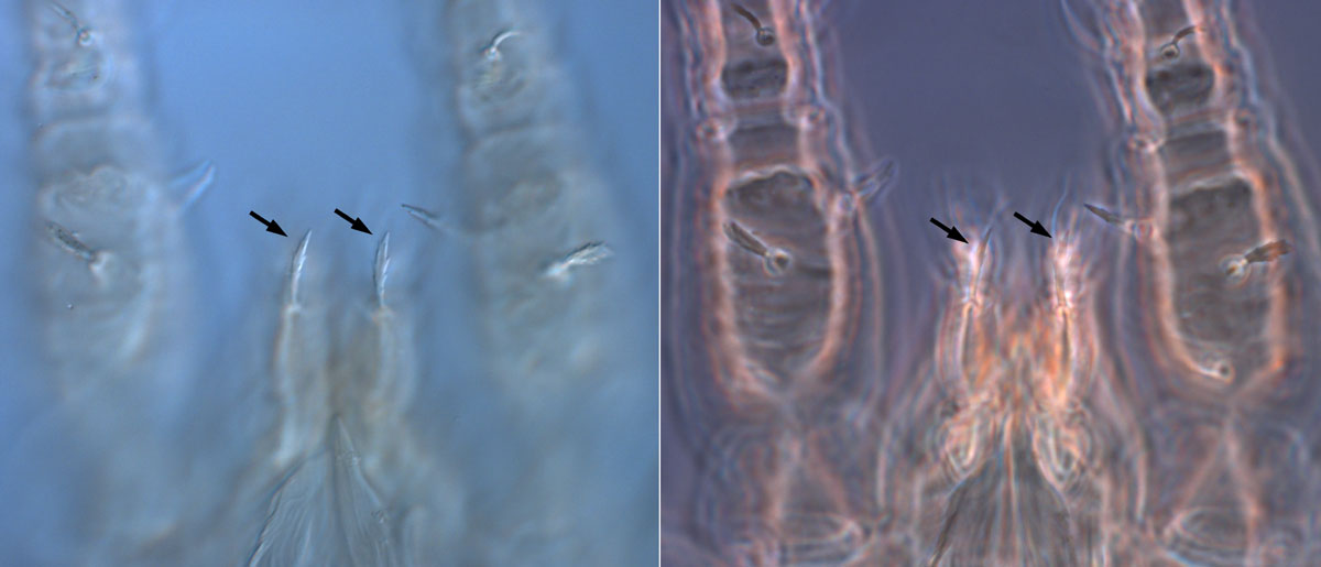 Brevipalpus phoenicis palps: Figure 4a (left) is DIC, Figure 4b (right) is phase contrast